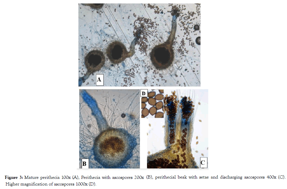 plant-pathology-microbiology-mature-perithecia