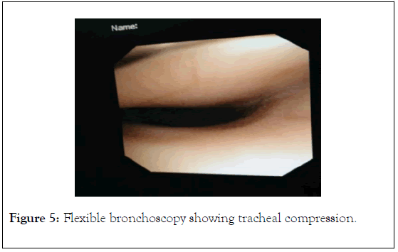 surgery-anesthesia-bronchoscopy