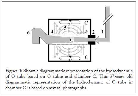 surgery-anesthesia-hydrodynamic