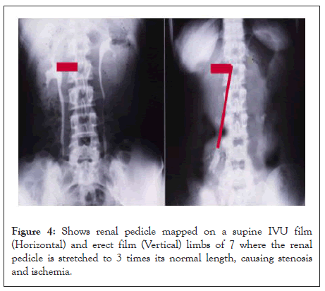 surgery-anesthesia-normal