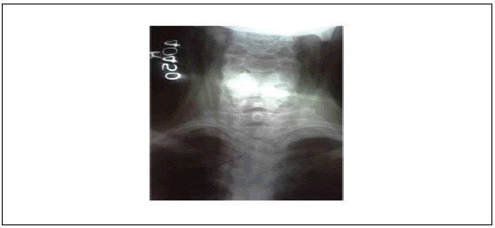 surgery-anesthesia-oesophagus