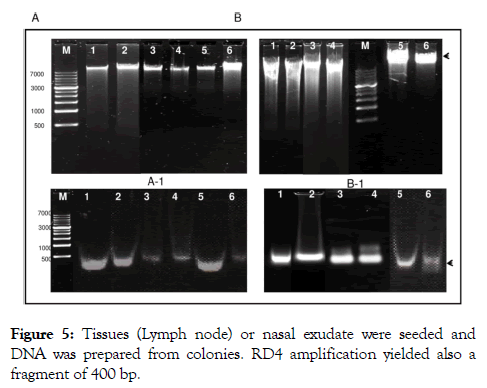 tropical-diseases-nasal-exudate