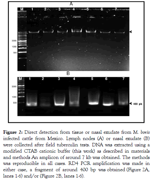 tropical-diseases-tissue-nasal-exudate