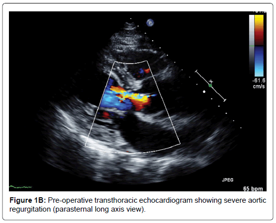 vascular-medicine-surgery-axis-view