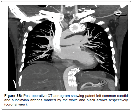 vascular-medicine-surgery-coronal-view