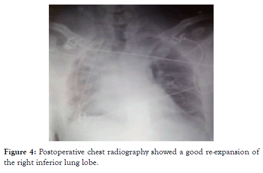 vascular-medicine-surgery-radiography