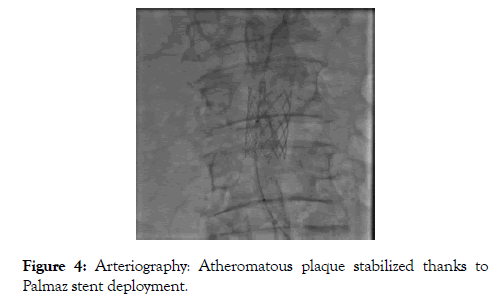 vascular-medicine-surgery-stabilized-thanks