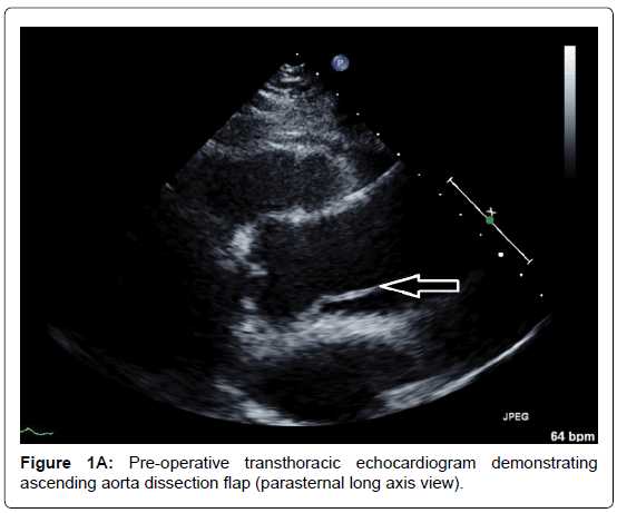 vascular-medicine-surgery-transthoracic-echocardiogram