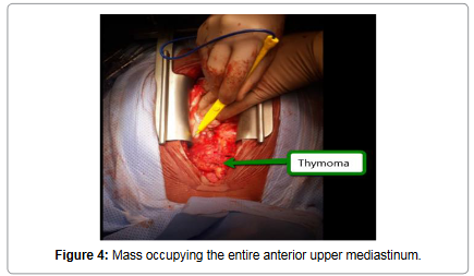 vascular-medicine-spenic-artery-mass-occupying-anterior