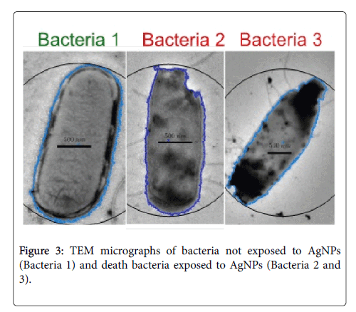 Biology-Medicine-death-bacteria
