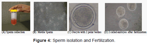 allergy-therapy-Sperm-isolation
