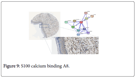 allergy-therapy-calcium-binding
