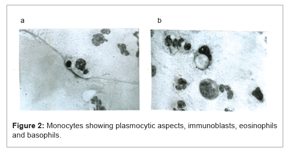 allergy-therapy-plasmocytic-aspects