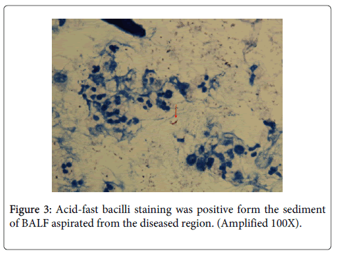 bacteriology-parasitology-Acid-fast-bacilli
