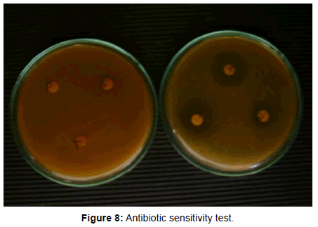 bacteriology-parasitology-Antibiotic-sensitivity-Test