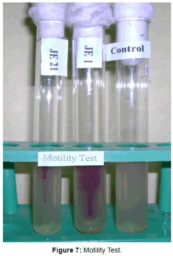 bacteriology-parasitology-Motility-Test