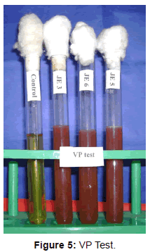 bacteriology-parasitology-VP-Test