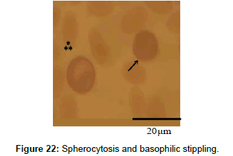 bacteriology-parasitology-basophilic-stippling