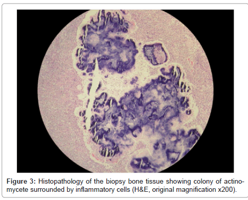 bacteriology-parasitology-biopsy-bone