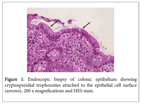 bacteriology-parasitology-colonic-epithelium