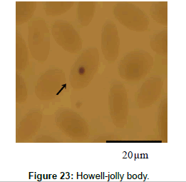 bacteriology-parasitology-jolly-body