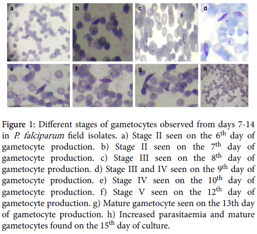 bacteriology-parasitology-stages-gametocytes