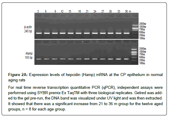 bioenergetics-reverse-transcription-quantitative
