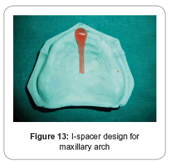 biology-and-medicine-I-spacer-design-maxillary-arch