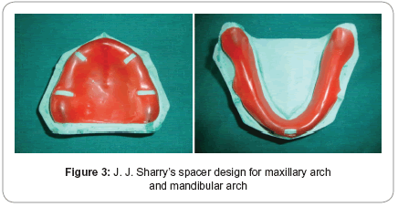 biology-and-medicine-spacer-design-maxillary-arch