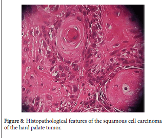 biology-and-medicine-squamous-cell