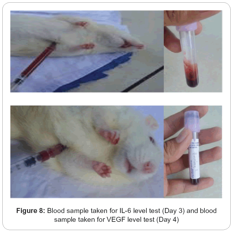 biology-medicine-Blood-sample