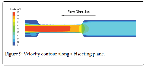 biology-medicine-Velocity-contour-bisecting-plane