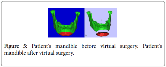 biology-medicine-mandible-surgery-virtual