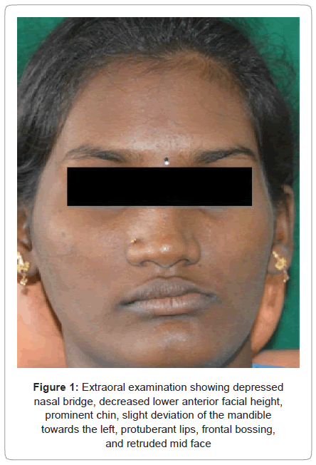 biology-medicine-nasal-bridge-lower-anterior-facial
