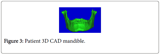 biology-medicine-patient-CAD-mandible