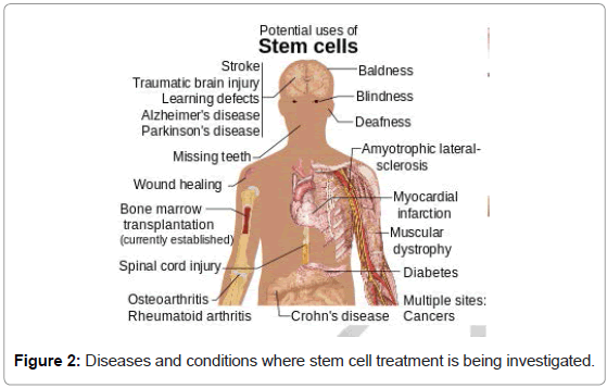 brain-disorders-therapy-Diseases-stem-cell