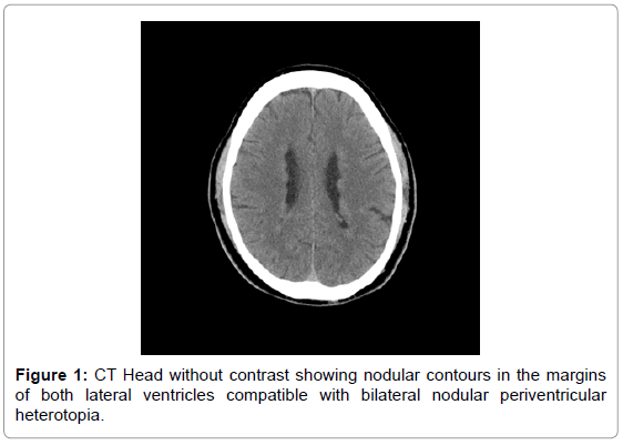 brain-disorders-therapy-Head-contrast-nodular