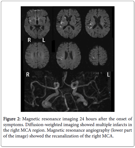 brain-disorders-therapy-Magnetic-resonance-imaging