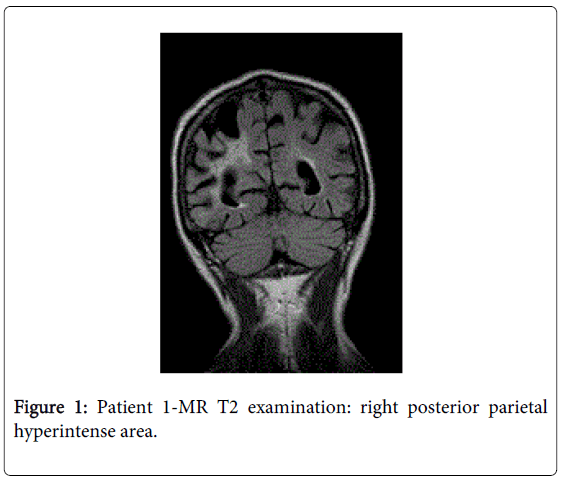 brain-disorders-therapy-Patient-examination-posterior
