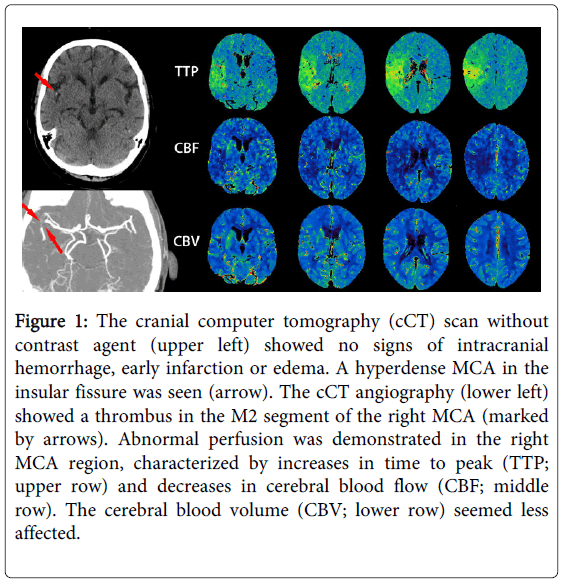 brain-disorders-therapy-cranial-computer-tomography