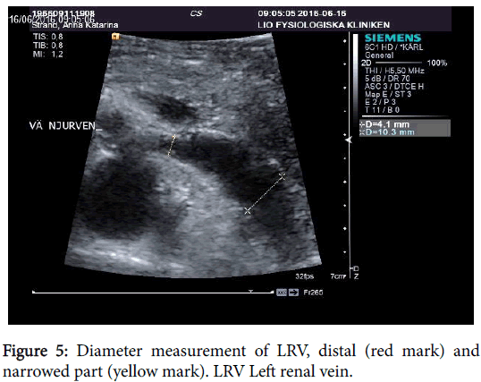 cardiovascular-pharmacology-Diameter-measurement-LRV