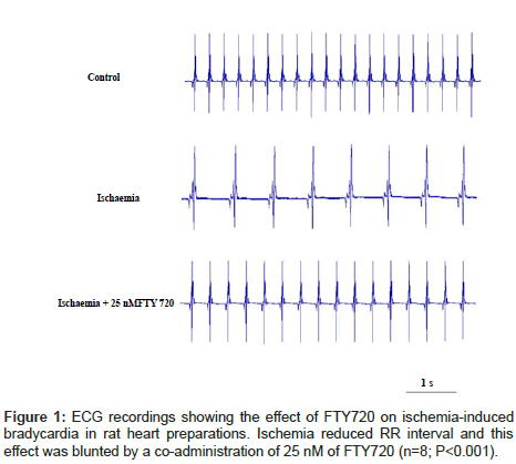 cardiovascular-pharmacology-ECG-recordings