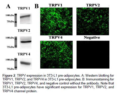 cardiovascular-pharmacology-TRPV-expression