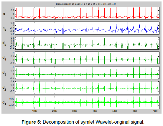 cardiovascular-pharmacology-Wavelet-original-signal