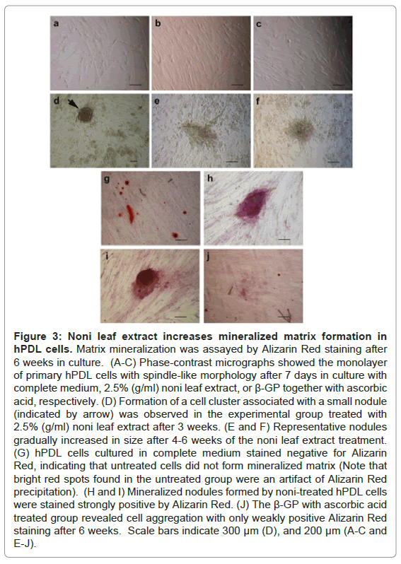 Morinda citrifolia Leaf Enhances In Vitro Osteogenic Differentiation