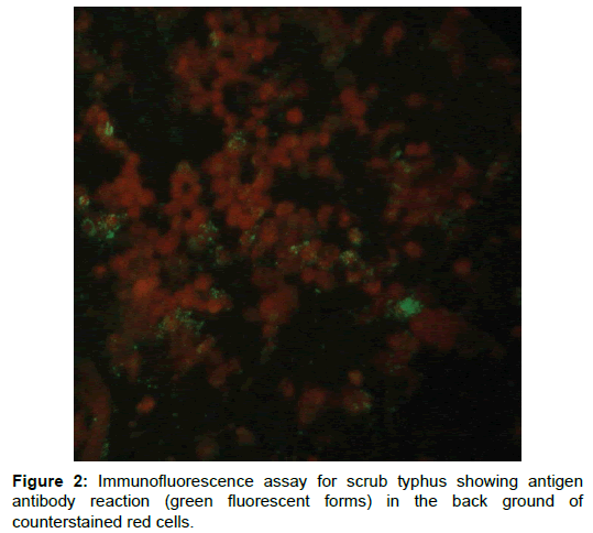 microbial-biochemical-technology-immunofluorescence-scrub-typhus