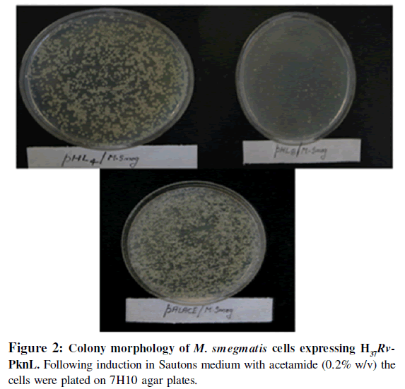 microbial-biochemical-technology-morphology-sautons-acetamide