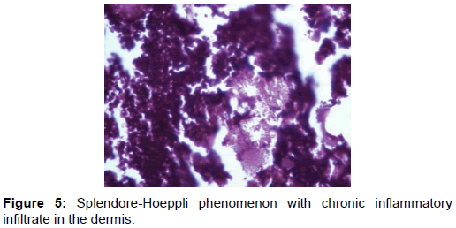 microbial-biochemical-technology-splendore-hoeppli-chronic