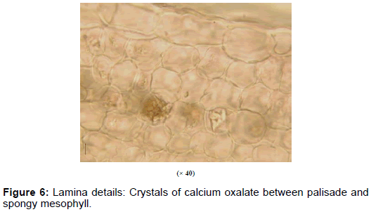 pharmaceutica-analytica-acta-Crystals-calcium-oxalate