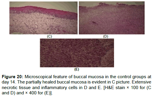 pharmaceutica-analytica-acta-feature-buccal-mucosa